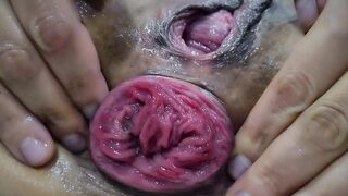 Fisting anal. Prolapse. Purchase plan.