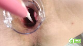 Gyno exam with speculum close up in hairy pussy