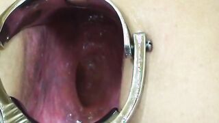 take a good look up my anus