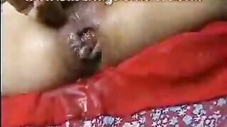 See an asshole from the inside, prolapse city!