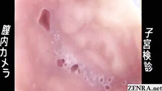Subtitled Japanese medical clinic internal vagina camera